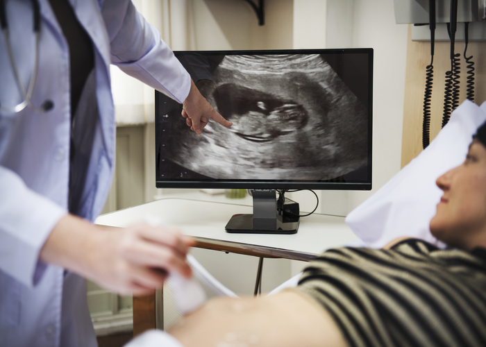scanfetal